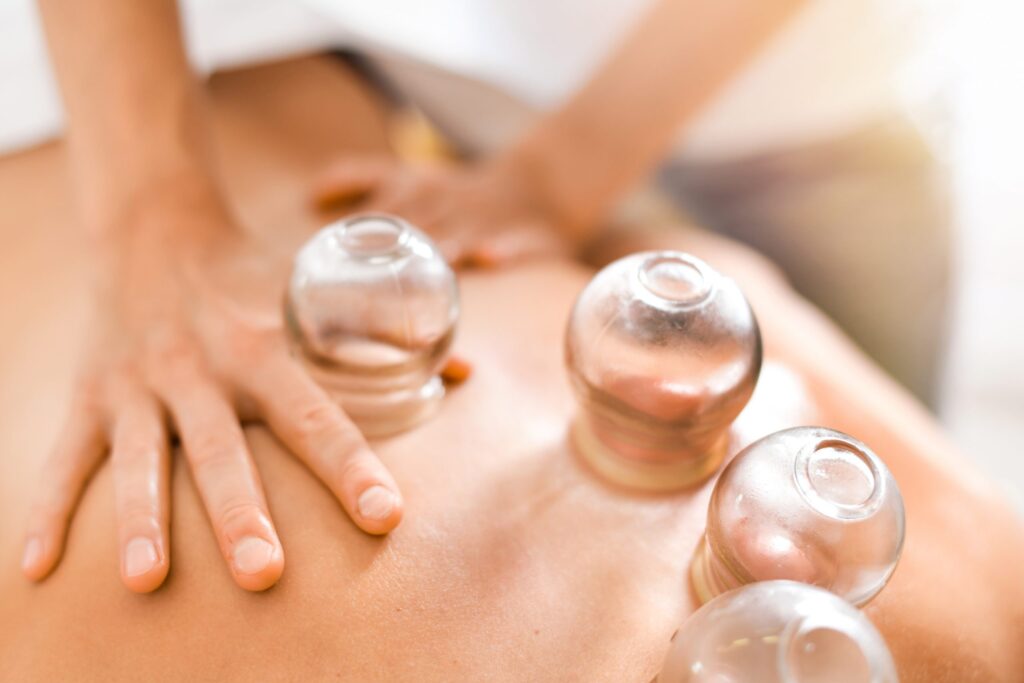 Cupping at Pleasant Wellness